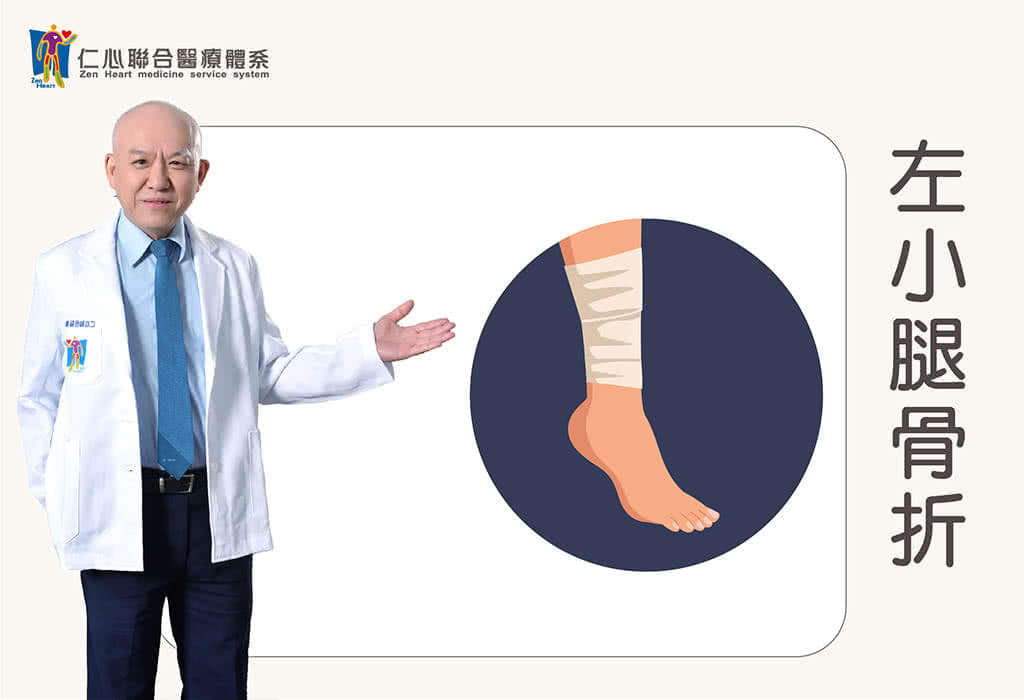 左小腿骨折