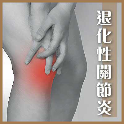 退化性关节炎